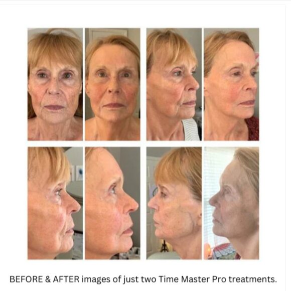 Time Master Pro beauty device, new - Picture 14 of 14